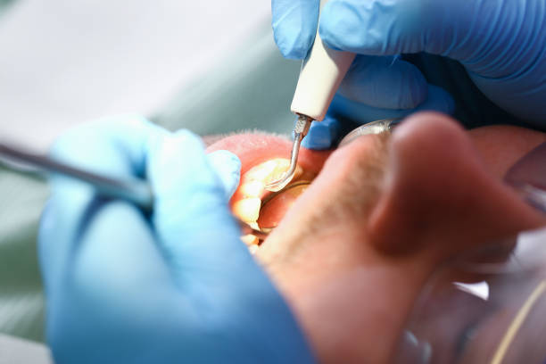 Best Emergency Treatment for Dental Infections or Abscesses in Bliss Corner, MA